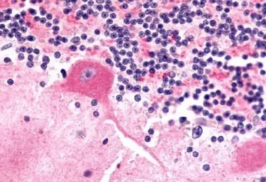 Anti-Frizzled 9 antibody used in IHC (Paraffin sections) (IHC-P). GTX71581