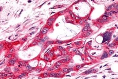 Anti-Frizzled 9 antibody used in IHC (Paraffin sections) (IHC-P). GTX71581