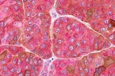 Anti-Frizzled 9 antibody used in IHC (Paraffin sections) (IHC-P). GTX71581