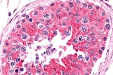 Anti-Frizzled 9 antibody used in IHC (Paraffin sections) (IHC-P). GTX71581