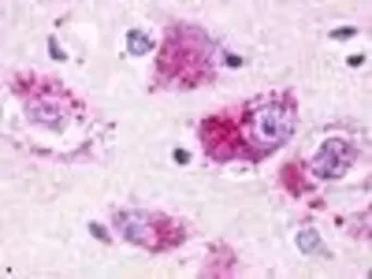 Anti-GPR100 antibody used in IHC (Paraffin sections) (IHC-P). GTX71607