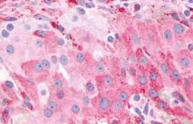 Anti-PTGFR antibody used in IHC (Paraffin sections) (IHC-P). GTX71639