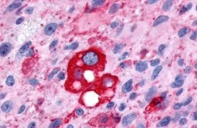 Anti-PTGFR antibody used in IHC (Paraffin sections) (IHC-P). GTX71639