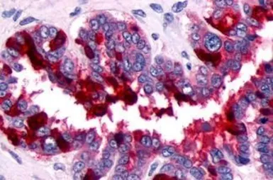Anti-PTGFR antibody used in IHC (Paraffin sections) (IHC-P). GTX71639