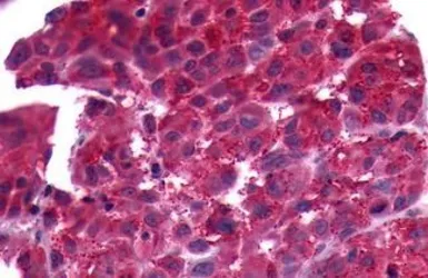 Anti-PTGFR antibody used in IHC (Paraffin sections) (IHC-P). GTX71639