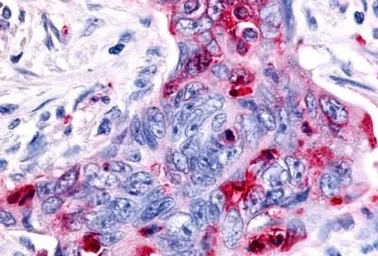 Anti-RON antibody used in IHC (Paraffin sections) (IHC-P). GTX71655