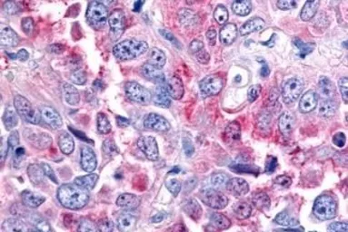 Anti-RON antibody used in IHC (Paraffin sections) (IHC-P). GTX71655