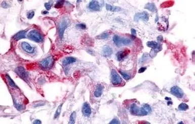 Anti-RON antibody used in IHC (Paraffin sections) (IHC-P). GTX71655