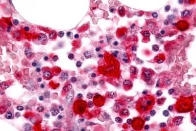 Anti-RON antibody used in IHC (Paraffin sections) (IHC-P). GTX71655
