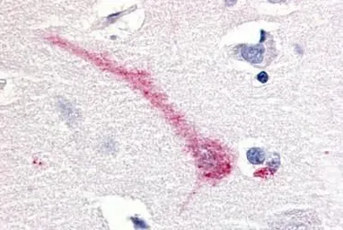 Anti-RON antibody used in IHC (Paraffin sections) (IHC-P). GTX71655