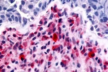 Anti-RON antibody used in IHC (Paraffin sections) (IHC-P). GTX71655
