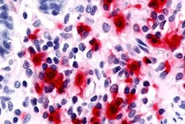 Anti-RON antibody used in IHC (Paraffin sections) (IHC-P). GTX71655