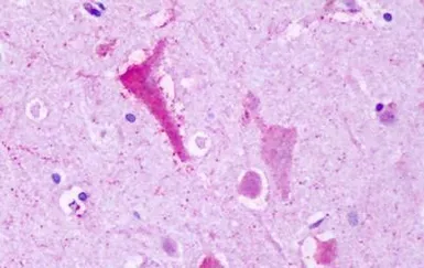 Anti-TM7SF1/GPR137B antibody used in IHC (Paraffin sections) (IHC-P). GTX71669