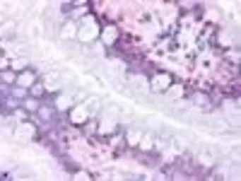 Anti-PTGDR antibody used in IHC (Paraffin sections) (IHC-P). GTX71677