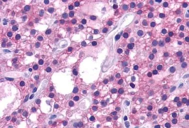 Anti-Calcium Sensing Receptor antibody used in IHC (Paraffin sections) (IHC-P). GTX71753