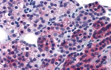 Anti-Calcium Sensing Receptor antibody used in IHC (Paraffin sections) (IHC-P). GTX71753