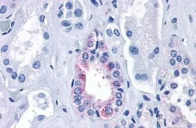 Anti-Calcium Sensing Receptor antibody used in IHC (Paraffin sections) (IHC-P). GTX71753