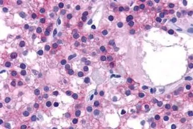 Anti-Calcium Sensing Receptor antibody used in IHC (Paraffin sections) (IHC-P). GTX71753
