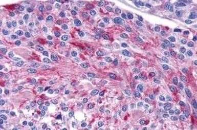 Anti-Calcium Sensing Receptor antibody used in IHC (Paraffin sections) (IHC-P). GTX71753