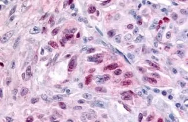 Anti-NR1D2 antibody used in IHC (Paraffin sections) (IHC-P). GTX71803