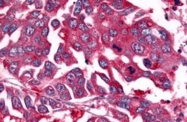 Anti-NEK7 antibody used in IHC (Paraffin sections) (IHC-P). GTX71879