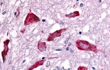Anti-PAK5 antibody used in IHC (Paraffin sections) (IHC-P). GTX71887