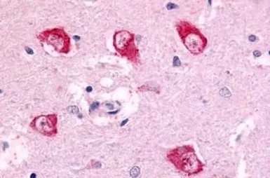 Anti-PAK5 antibody used in IHC (Paraffin sections) (IHC-P). GTX71887