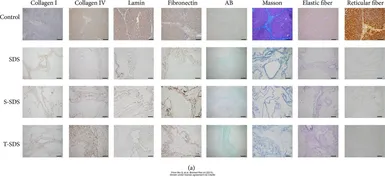 Anti-Fibronectin antibody used in IHC (Paraffin sections) (IHC-P). GTX72724