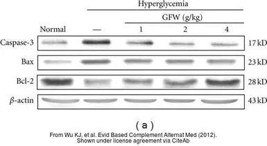 Anti-Caspase 3 antibody used in Western Blot (WB). GTX73090