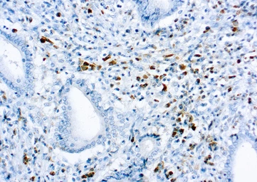 Rabbit Anti-Human kappa light chain antibody. GTX73364
