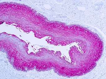 Anti-pan Cytokeratin antibody (ready-to-use) used in IHC (Paraffin sections) (IHC-P). GTX73375