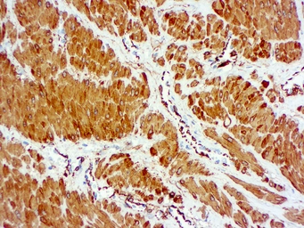 Anti-alpha Smooth Muscle Actin antibody [1A4] (ready-to-use) used in IHC (Paraffin sections) (IHC-P). GTX73419