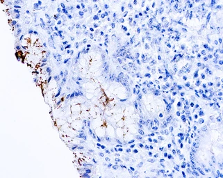 Anti-Helicobacter pylori antibody used in IHC (Paraffin sections) (IHC-P). GTX73544
