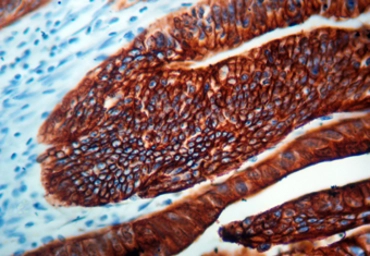 Anti-Cytokeratin 20 antibody [KS 20.8] (ready-to-use) used in IHC (Paraffin sections) (IHC-P). GTX73572