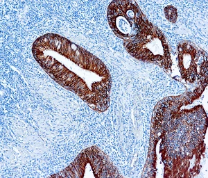 Anti-pan Cytokeratin antibody [AE1/AE3] used in IHC (Paraffin sections) (IHC-P). GTX73583