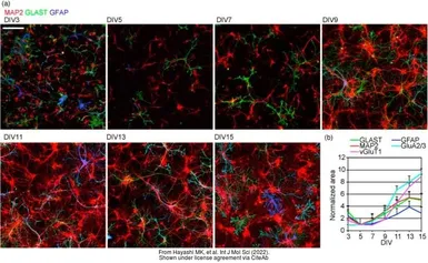 Anti-GFAP antibody [GA5] used in Immunocytochemistry/ Immunofluorescence (ICC/IF). GTX73615