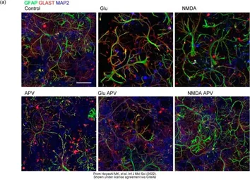 Anti-GFAP antibody [GA5] used in Immunocytochemistry/ Immunofluorescence (ICC/IF). GTX73615