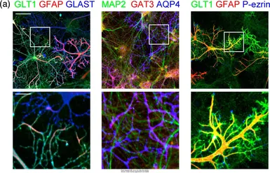 Anti-GFAP antibody [GA5] used in Immunocytochemistry/ Immunofluorescence (ICC/IF). GTX73615