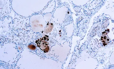 Anti-Calcitonin antibody used in IHC (Paraffin sections) (IHC-P). GTX73624