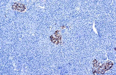 Anti-Chromogranin A antibody [LK2H10] (ready-to-use) used in IHC (Paraffin sections) (IHC-P). GTX73638
