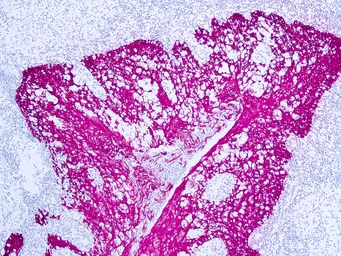 Anti-HMW Cytokeratin antibody [34βE12] used in IHC (Paraffin sections) (IHC-P). GTX73669