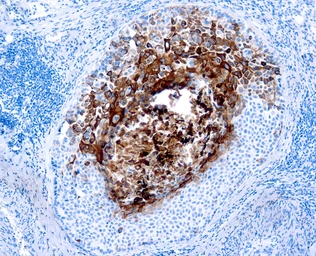 Anti-Cytokeratin 17 antibody [E3] used in IHC (Paraffin sections) (IHC-P). GTX73698