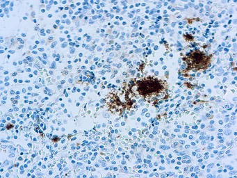 Anti-Integrin beta 3 antibody [Y2/51] used in IHC (Paraffin sections) (IHC-P). GTX73704