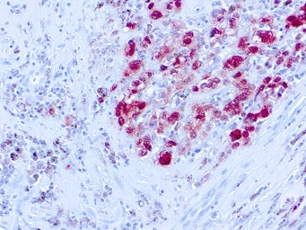 Anti-S100 antibody [SH-B1] used in IHC (Paraffin sections) (IHC-P). GTX73714