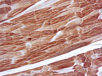 Anti-alpha Sarcomeric Actin antibody [5C5] used in IHC (Paraffin sections) (IHC-P). GTX73725