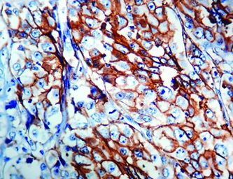 Anti-Epithelial antigen antibody [Ber-EP4] used in IHC (Paraffin sections) (IHC-P). GTX73737
