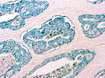 Anti-Epithelial antigen antibody [Ber-EP4] used in IHC (Paraffin sections) (IHC-P). GTX73737