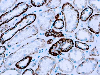 Anti-pan Cadherin antibody [CH-19] used in IHC (Paraffin sections) (IHC-P). GTX73744