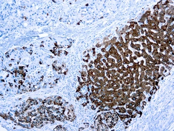 Anti-Hepatocyte Specific Antigen antibody [OCH1E5] used in IHC (Paraffin sections) (IHC-P). GTX73779