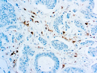 Anti-Thymidine Phosphorylase antibody [P-GF.44C] used in IHC (Paraffin sections) (IHC-P). GTX73918